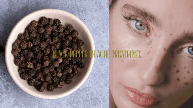 Black pepper in acne treatment